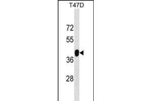 ZNF322A Antibody (C-term) (ABIN1537135 and ABIN2848990) western blot analysis in T47D cell line lysates (35 μg/lane).