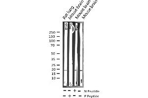 Western blot analysis of Phospho-Synuclein alpha (Tyr133) expression in various lysates (SNCA Antikörper  (pTyr133))