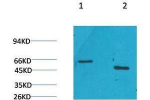 Western Blot (WB) analysis of 1) Rat Brain Tissue, 2)Mouse Brain Tissue with GLP1R Rabbit Polyclonal Antibody diluted at 1:2000. (GLP1R Antikörper)