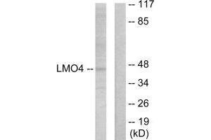 Western blot analysis of extracts from 293 cells, using LMO4 antibody. (LMO4 Antikörper  (C-Term))