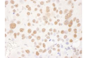 Immunohistochemistry (IHC) image for anti-Ubiquitin Specific Peptidase 7 (Herpes Virus-Associated) (USP7) (AA 1-50) antibody (ABIN7453454) (USP7 Antikörper  (AA 1-50))
