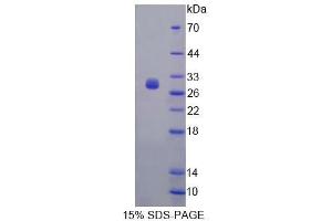 SDS-PAGE analysis of Mouse FBS Protein. (Fibrosin Protein (FBS))