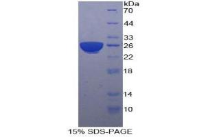 SDS-PAGE (SDS) image for Pregnancy Specific beta-1-Glycoprotein 1 (PSG1) (AA 202-401) protein (His tag) (ABIN1880069) (PSG1 Protein (AA 202-401) (His tag))