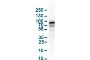 Western Blot analysis of human cell line RH-30. (NGFR Antikörper  (AA 281-421))