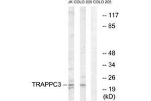 Western blot analysis of extracts from COLO/Jurkat cells, using TRAPPC3 Antibody. (TRAPPC3 Antikörper  (AA 131-180))