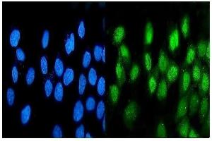 IF analysis of ATF1 using anti-ATF1 antibody (ABIN7599192). (AFT1 Antikörper  (AA 1-271))