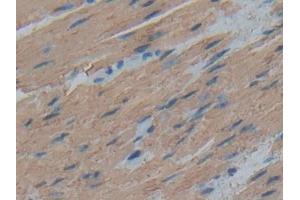 DAB staining on IHC-P; Samples: Human Esophagus Tissue