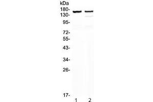 Western blot testing of 1) rat heart and 2) mouse heart lysate with MYBPC3 antibody at 0. (MYBPC3 Antikörper)