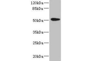 Western blot All lanes: KRT35 antibody at 4 μg/mL + PC-3 whole cell lysate Secondary Goat polyclonal to rabbit IgG at 1/10000 dilution Predicted band size: 51 kDa Observed band size: 51 kDa (Keratin 35 Antikörper  (AA 1-455))