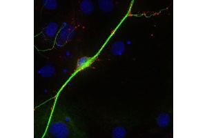 Indirect immunostaining of PFA fixed rat hippocampus neurons with anti-synaptoporin (1 : 500; red) and mouse anti-MAP 2 (, dilution 1 : 500; green). (Synaptoporin Antikörper  (C-Term))