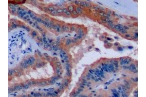Immunohistochemistry (IHC) image for anti-Keratin 8 (KRT8) (AA 92-393) antibody (ABIN7434548)