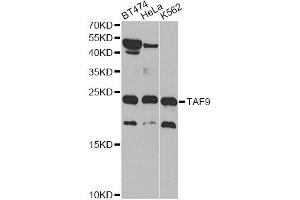 Western blot analysis of extracts of various cell lines, using TAF9 antibody (ABIN5971055) at 1/1000 dilution. (TAF9 Antikörper)