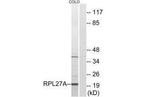 Western blot analysis of extracts from COLO cells, using RPL27A antibody. (RPL27A Antikörper  (C-Term))
