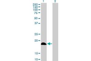 Western Blot analysis of DCTD expression in transfected 293T cell line by DCTD MaxPab polyclonal antibody. (DCMP Deaminase (DCTD) (AA 1-189) Antikörper)