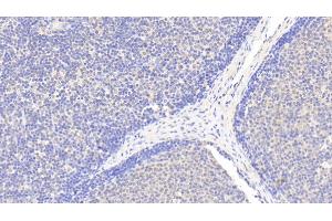 Detection of EMR1 in Human Lymph node Tissue using Polyclonal Antibody to EGF Like Module Containing Mucin Like Hormone Receptor 1 (EMR1) (F4/80 Antikörper  (AA 1-201))