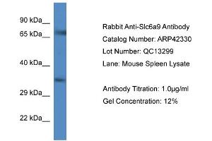Host:  Rabbit  Target Name:  SLC6A9  Sample Tissue:  Mouse Spleen  Antibody Dilution:  1ug/ml (GLYT1 Antikörper  (C-Term))