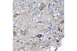 Immunohistochemistry of paraffin-embedded Mouse spinal cord using GULP1 Rabbit pAb (ABIN6131564, ABIN6141541, ABIN6141542 and ABIN6220256) at dilution of 1:100 (40x lens). (GULP1 Antikörper  (AA 1-130))
