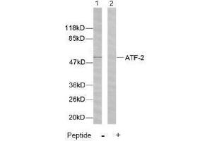 Image no. 2 for anti-Activating Transcription Factor 2 (ATF2) (Ser44), (Ser62) antibody (ABIN197144) (ATF2 Antikörper  (Ser44, Ser62))