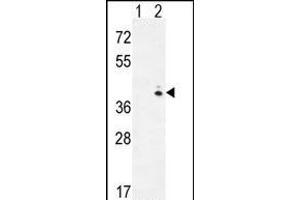 Western blot analysis of GALK1 (arrow) using rabbit polyclonal hGALK1- (ABIN391114 and ABIN2841244). (GALK1 Antikörper  (C-Term))