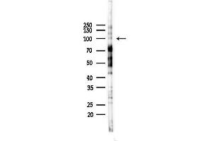 anti-ATP/GTP Binding Protein-Like 2 (AGBL2) (C-Term) antibody