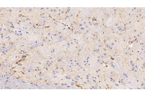 Detection of GFAP in Mouse Spinal cord Tissue using Polyclonal Antibody to Glial Fibrillary Acidic Protein (GFAP) (GFAP Antikörper  (AA 253-354))