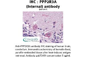 Image no. 1 for anti-Protein Phosphatase 2, Regulatory Subunit B'', alpha (PPP2R3A) (Internal Region) antibody (ABIN1738304) (PPP2R3A Antikörper  (Internal Region))