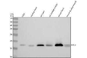 Western blot analysis of Myosin Light Chain 2/MLC-2V/MYL2 using anti-Myosin Light Chain 2/MLC-2V/MYL2 antibody (ABIN7602905).