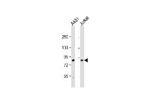 Western Blot at 1:1000 dilution Lane 1: A431 whole cell lysate Lane 2: Jurkat whole cell lysate Lysates/proteins at 20 ug per lane. (DGKA Antikörper  (C-Term))