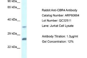 Western Blotting (WB) image for anti-Carbonyl Reductase 4 (CBR4) (C-Term) antibody (ABIN2788530) (CBR4 Antikörper  (C-Term))