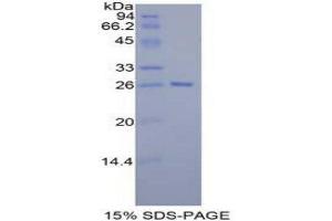 SDS-PAGE (SDS) image for Tafazzin (TAZ) (AA 46-240) protein (His tag) (ABIN2126915) (TAZ Protein (AA 46-240) (His tag))