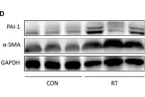 Establishment and confirmation of radiation-induced lung fibrosis in a murine model. (GAPDH Antikörper)