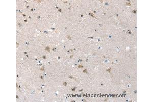 Immunohistochemistry of Human brain using SLC6A7 Polyclonal Antibody at dilution of 1:30