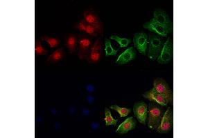ABIN7093891 and ABIN7097934 staining Hela cells by IF/ICC.
