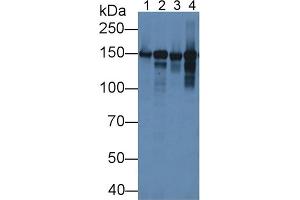 Rabbit Detection antibody from the kit in WB with Positive Control: Mouse heart lysate.
