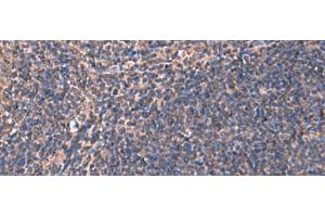 Immunohistochemistry of paraffin-embedded Human tonsil tissue using RHAG Polyclonal Antibody at dilution of 1:130(x200) (RHAG Antikörper)