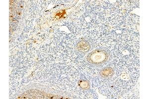 ABIN6256005 and ABIN6267245 at 1/100 staining Rat ovary tissue by IHC-P. (ROCK2 Antikörper  (pTyr722))
