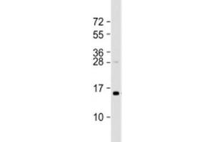 Western blot testing of human HT-1080 cell lysate with TAX1BP3 antibody at 1:2000. (TAX1BP3 Antikörper  (AA 71-103))