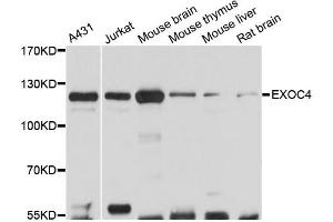 Western blot analysis of extracts of various cell lines, using EXOC4 antibody (ABIN6290368) at 1:3000 dilution. (Sec8 Antikörper)