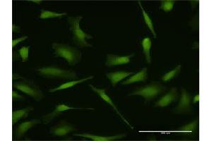 Immunofluorescence of purified MaxPab antibody to MDM4 on HeLa cell. (MDM4-binding Protein Antikörper  (AA 1-490))