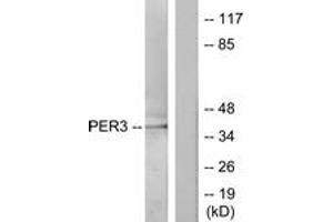 Western blot analysis of extracts from Jurkat cells, treated with insulin 0. (PER3 Antikörper  (AA 21-70))