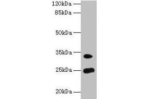 Western blot All lanes: MREG antibody at 8 μg/mL + Mouse stomach tissue Secondary Goat polyclonal to rabbit IgG at 1/10000 dilution Predicted band size: 25, 27 kDa Observed band size: 25, 33 kDa (MREG Antikörper  (AA 1-214))
