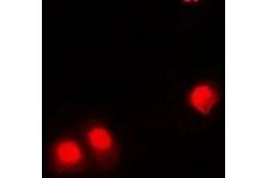 Immunofluorescent analysis of CHD4 staining in HEK293 cells.