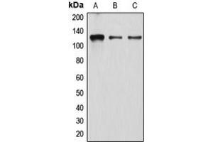Western blot analysis of Atrophin-1 expression in K562 (A), EOC20 (B), HeLa (C) whole cell lysates.