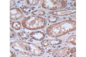 Used in DAB staining on fromalin fixed paraffin- embedded kidney tissue (FASTK Antikörper  (AA 330-524))