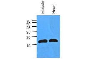 Image no. 1 for anti-Myoglobin (MB) (AA 1-154), (N-Term) antibody (ABIN953585) (Myoglobin Antikörper  (N-Term))