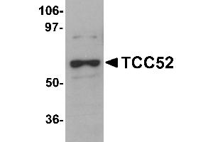 Western Blotting (WB) image for anti-DDB1 and CUL4 Associated Factor 12 (DCAF12) (C-Term) antibody (ABIN1030723) (DCAF12 Antikörper  (C-Term))