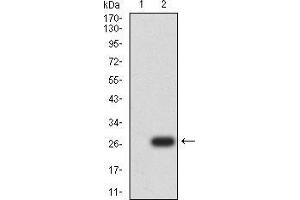 Western Blotting (WB) image for anti-Uncoupling Protein 3 (Mitochondrial, Proton Carrier) (UCP3) (AA 1-113), (AA 217-312) antibody (ABIN5871957) (UCP3 Antikörper  (AA 1-113, AA 217-312))
