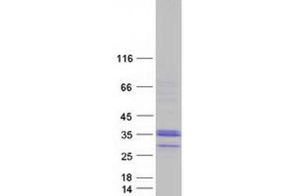 C1QL3 Protein (Myc-DYKDDDDK Tag)