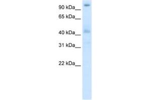 Western Blotting (WB) image for anti-Pogo Transposable Element with ZNF Domain (POGZ) antibody (ABIN2461864) (POGZ Antikörper)