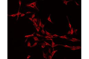 ABIN6275303 staining Hela by IF/ICC. (NMS Antikörper  (C-Term))